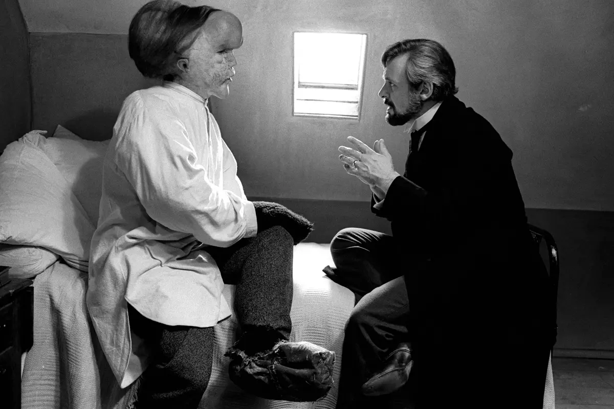 John Hurt ed Anthony Hopkins in The Elephant Man (1980) - @Webphoto